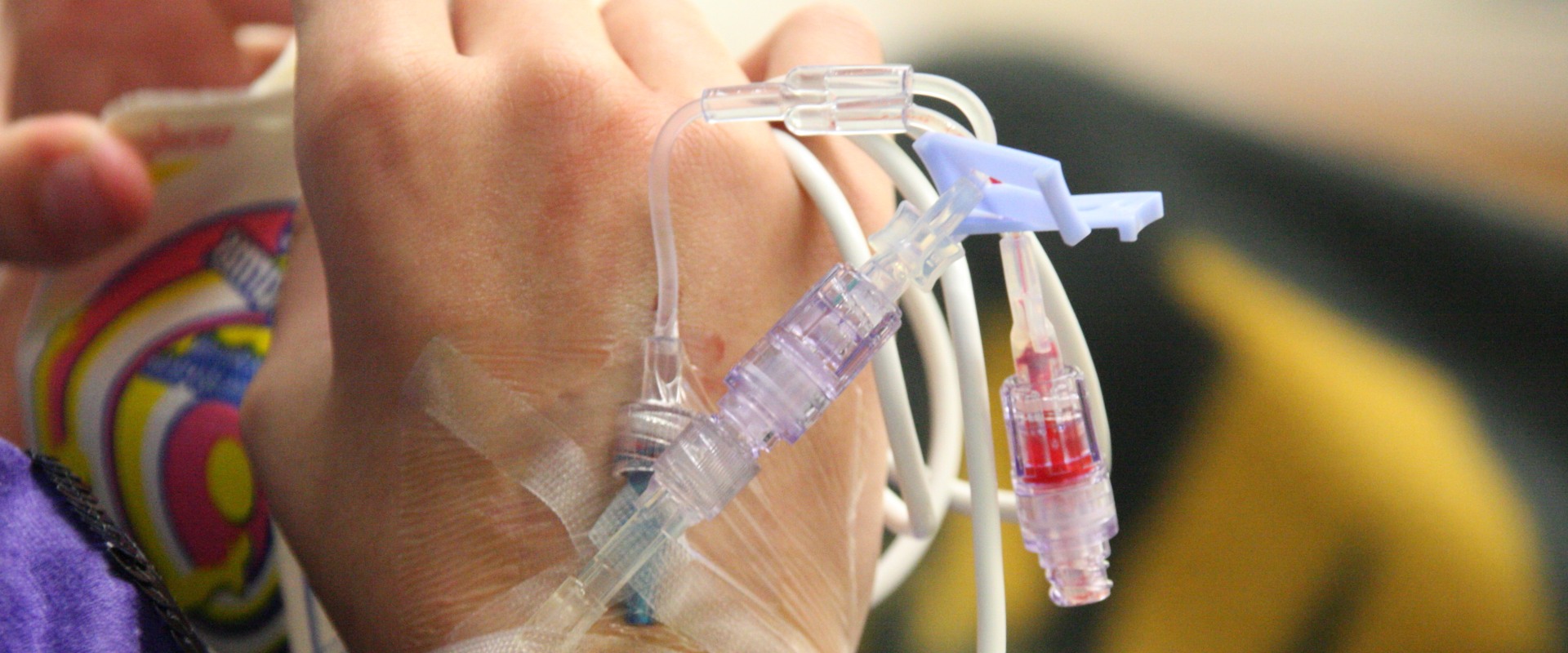 Is Radiation Worse Than Chemotherapy?