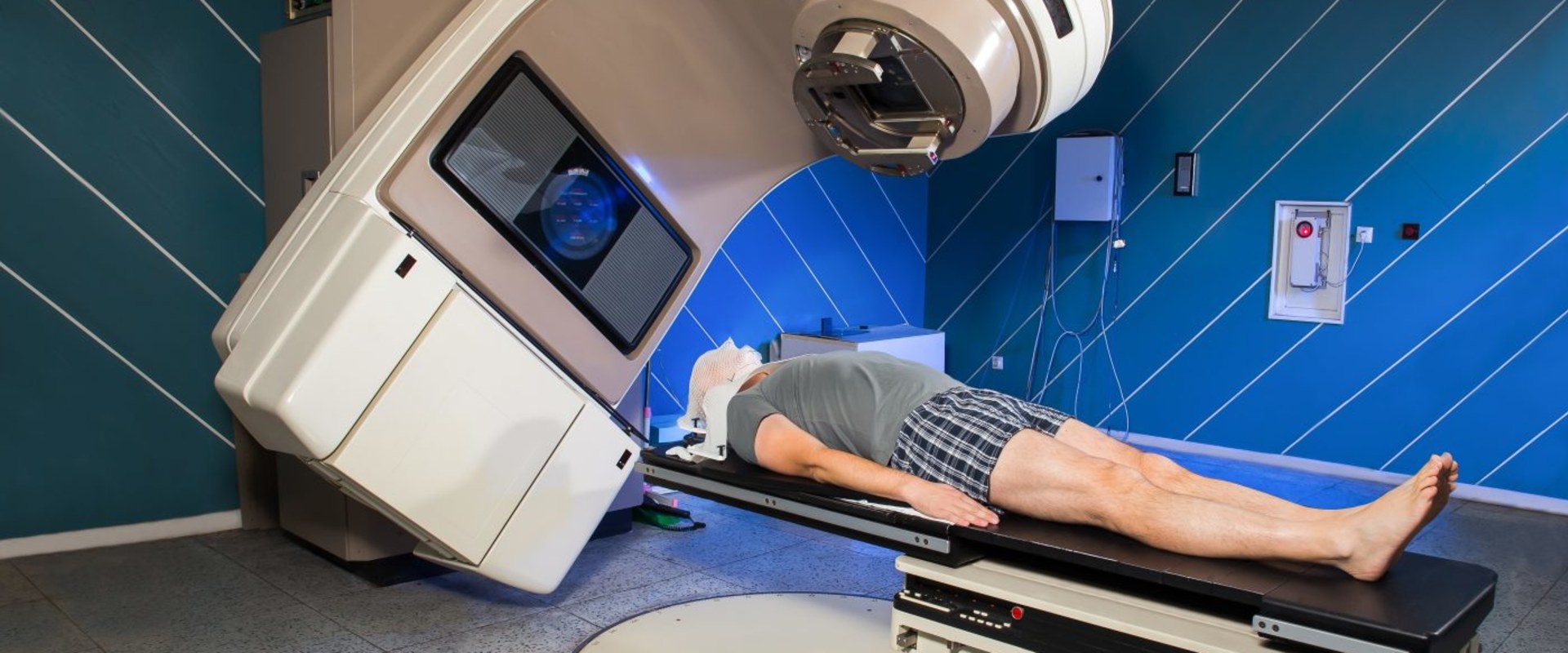 What are the Side Effects of Radiation Therapy for Cancer?