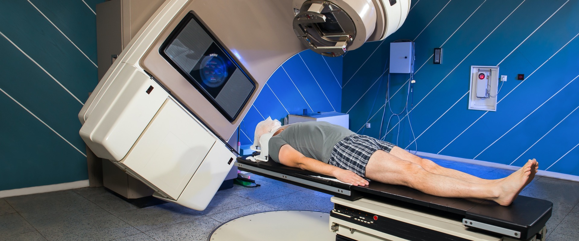 What are the Side Effects of Cancer Radiation Treatment?