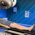 What are the Side Effects of Radiation Therapy for Cancer?