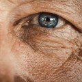 Can Cancer Treatment Affect Your Eyesight?