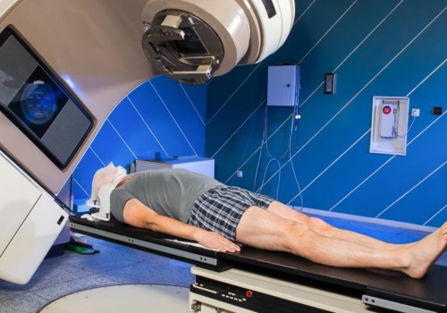 What are the Side Effects of Radiation Therapy for Cancer?